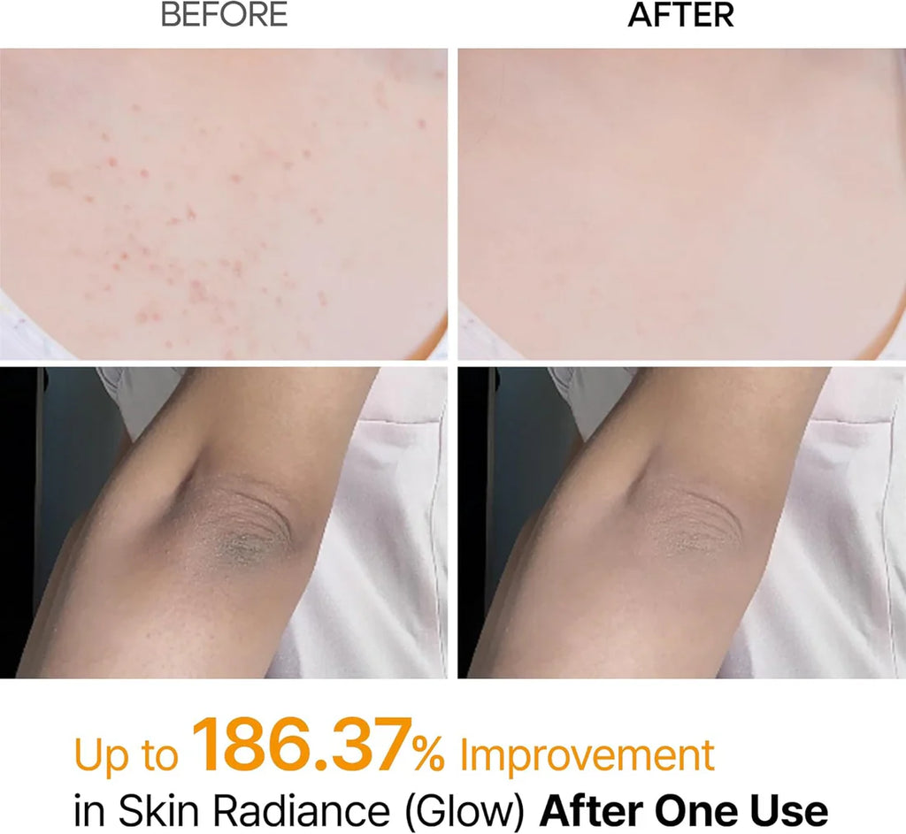 Dr.Melaxin Peel Shot