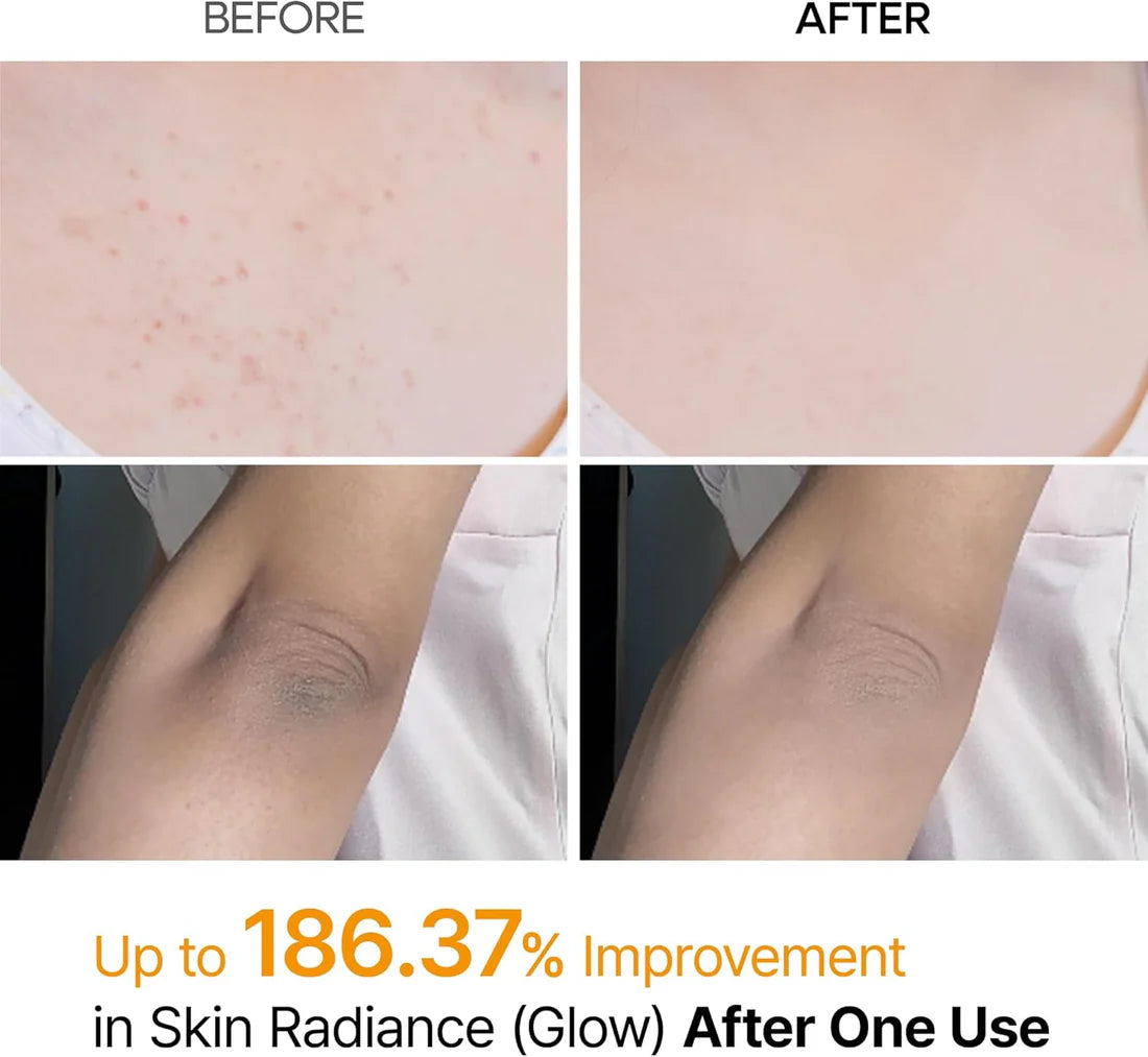 Dr.Melaxin Peel Shot